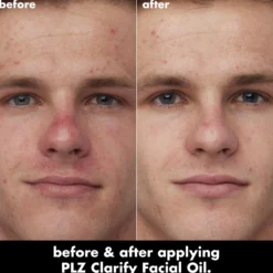 PLZ Clarify Facial Oil