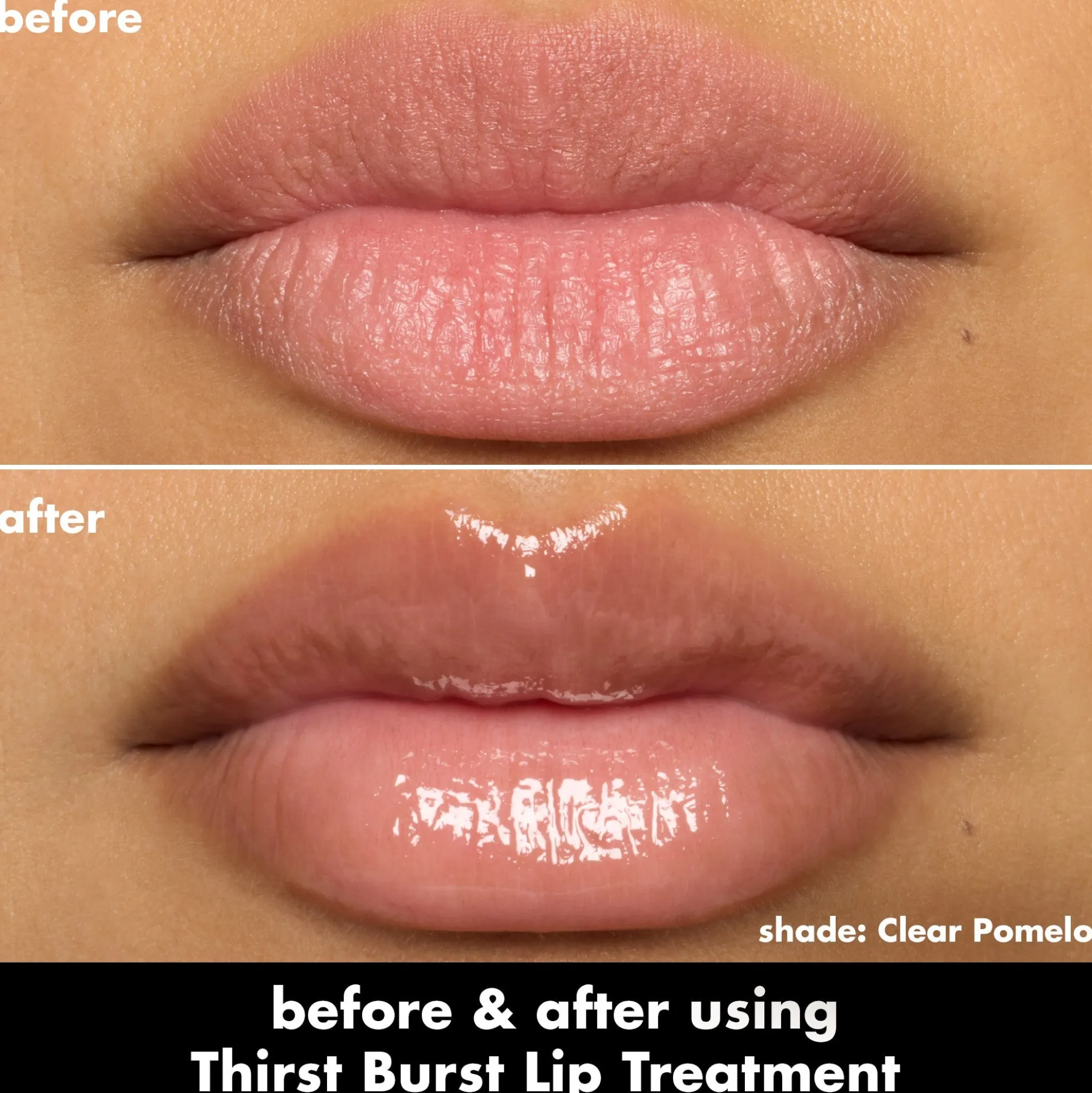 Thirst Burst Lip Treatment